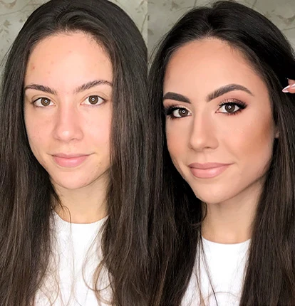 Antes e Depois 1