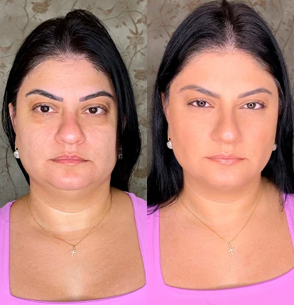 Antes e Depois 10