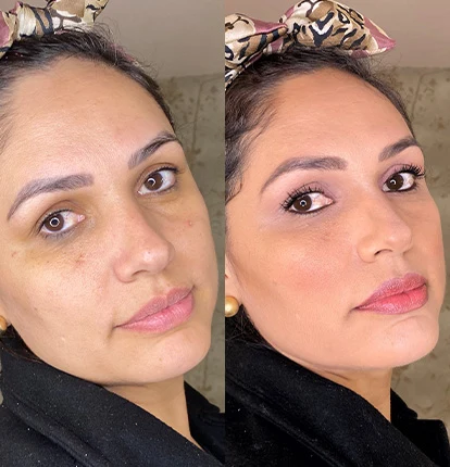 Antes e Depois 11