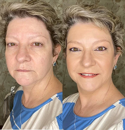Antes e Depois 12
