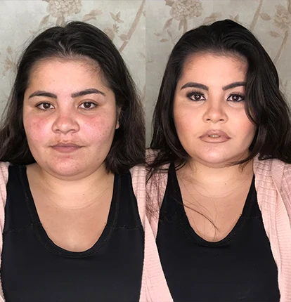 Antes e Depois 15