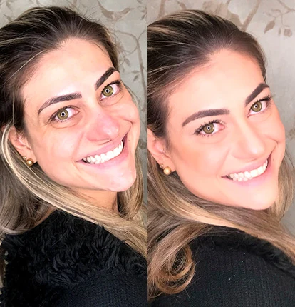 Antes e Depois 16