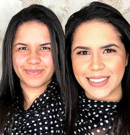 Antes e Depois 17