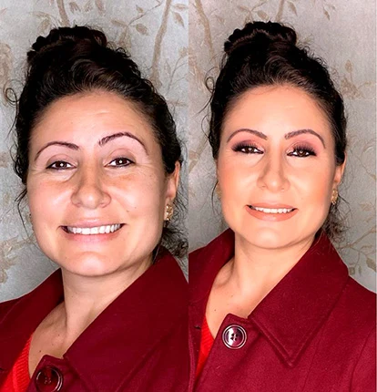Antes e Depois 18
