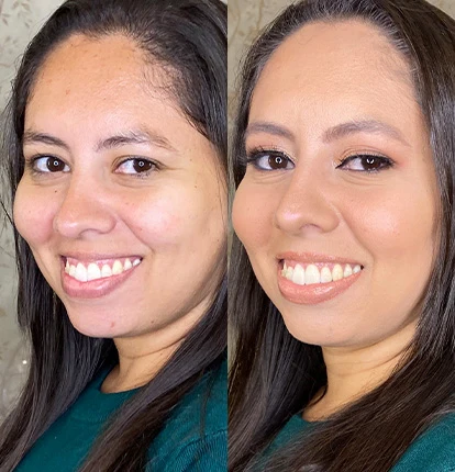 Antes e Depois 2