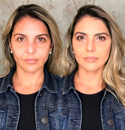 Antes e Depois 3