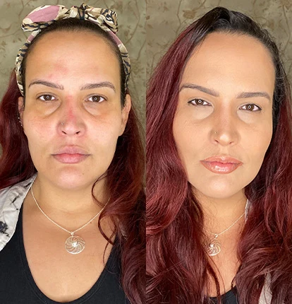 Antes e Depois 4