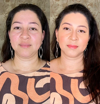 Antes e Depois 5