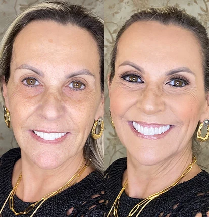 Antes e Depois 6