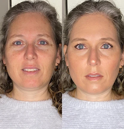 Antes e Depois 7