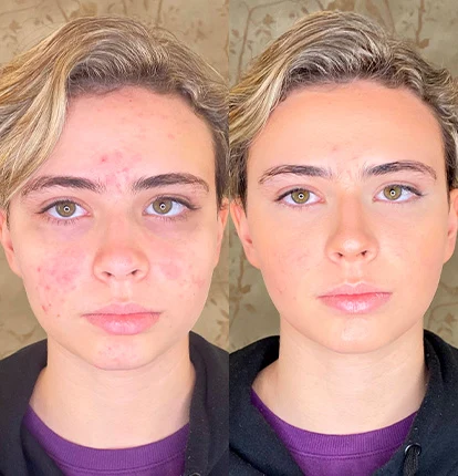 Antes e Depois 8
