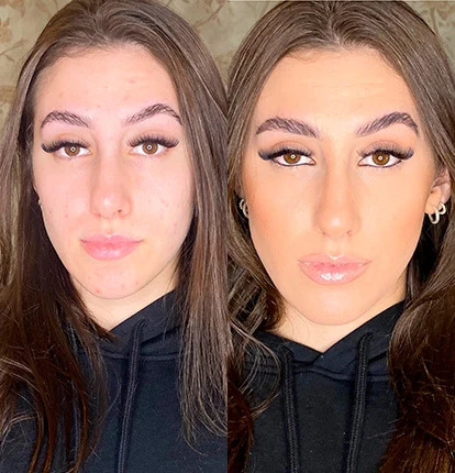 Antes e Depois 9